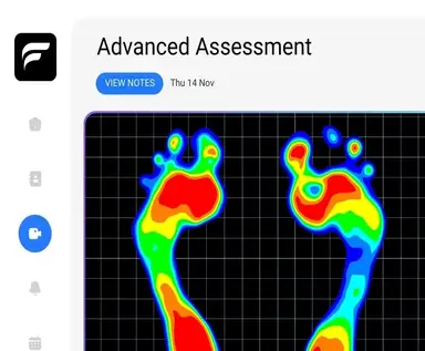 Gait Analysis