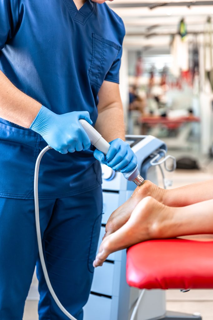 Patient getting non-surgical treatment with shock waves for plantar fasciitis